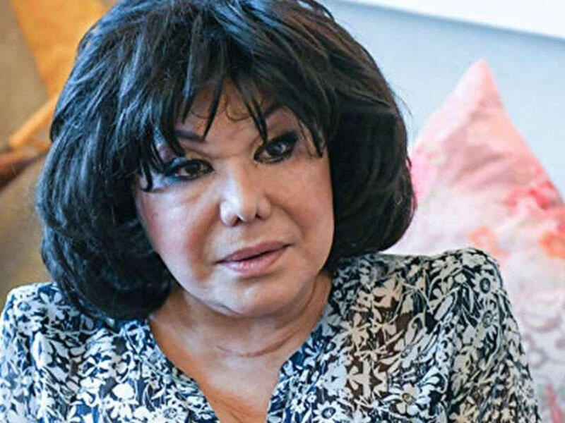  Flora Kərimova reanimasiyaya yerləşdirilib - 40 gün ac qalıbmış + FOTO 